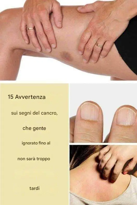 segnali allarmanti del cancro