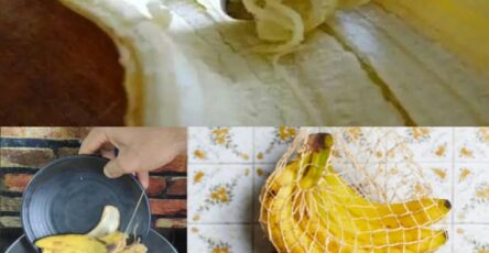 bucce di banana utili