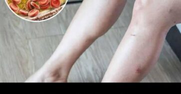problemi cardiaci piedi