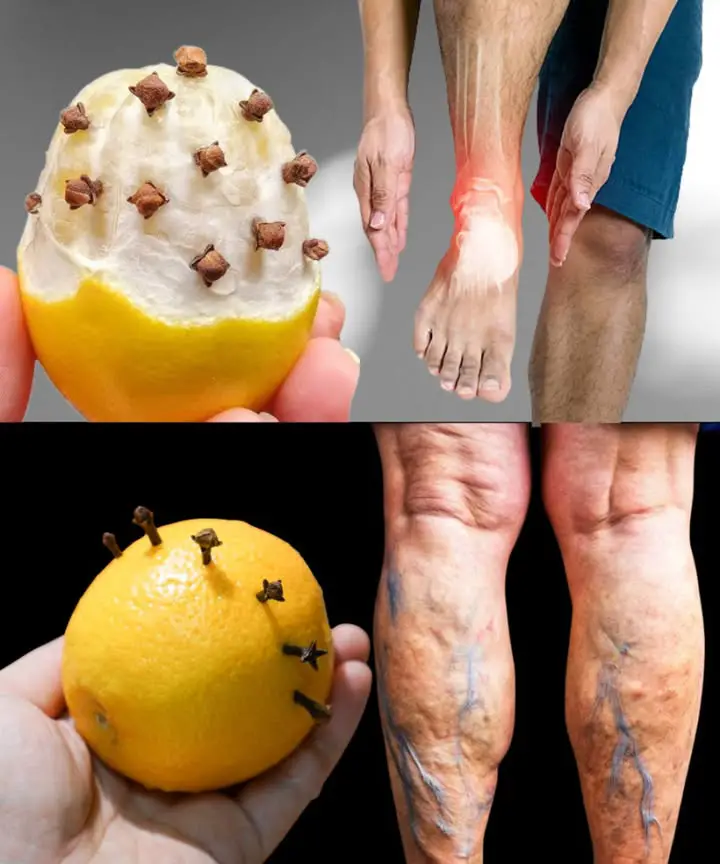 rimedi naturali al limone
