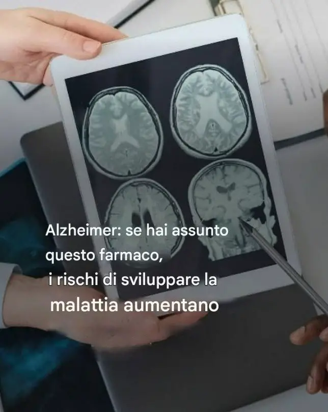farmaco e Alzheimer