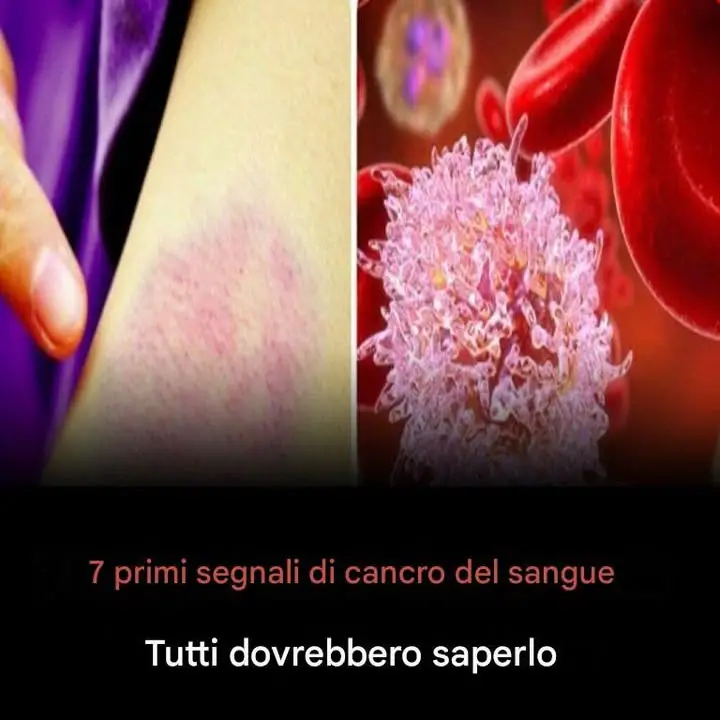 segni tumore del sangue