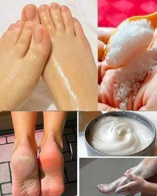 bicarbonato pedicure a casa
