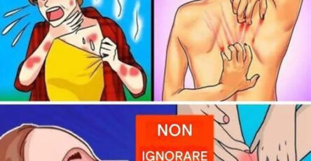 Anemia