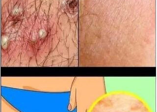 Segnali di Allerta
