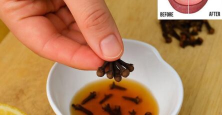 Il Potere Dei Chiodi Di Garofano: La Piccola Cura Naturale Per Il Bruciore Alla Gola