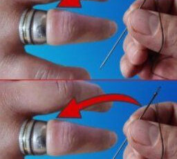 Come Rimuovere Facilmente Un Anello Incastato Dal Dito Con Un Ago