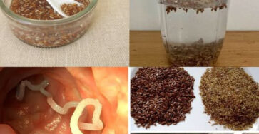 Elimina Rapidamente I Parassiti Intestinali Nascosti Con Questo Semplice Rimedio A Base Di Semi Di Lino