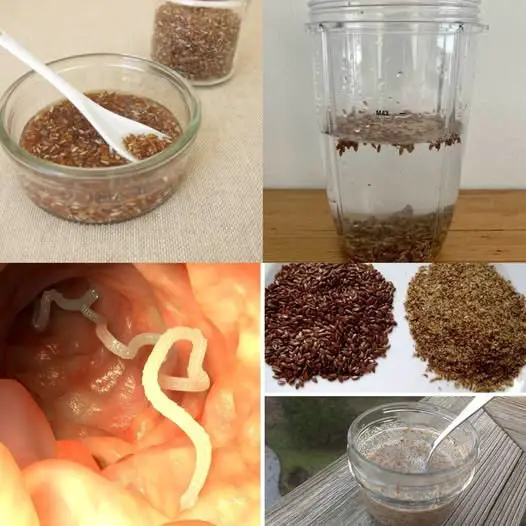 Elimina Rapidamente I Parassiti Intestinali Nascosti Con Questo Semplice Rimedio A Base Di Semi Di Lino