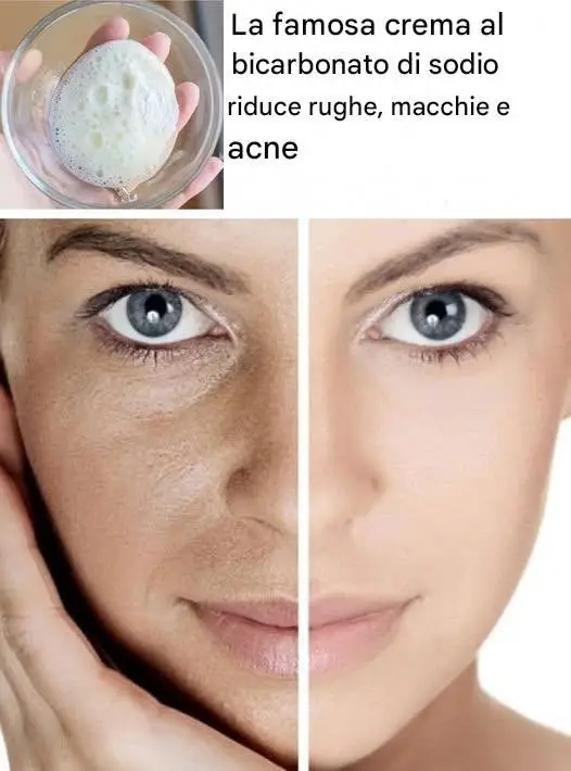 Crema al bicarbonato di sodio riduce rughe macchie e acne