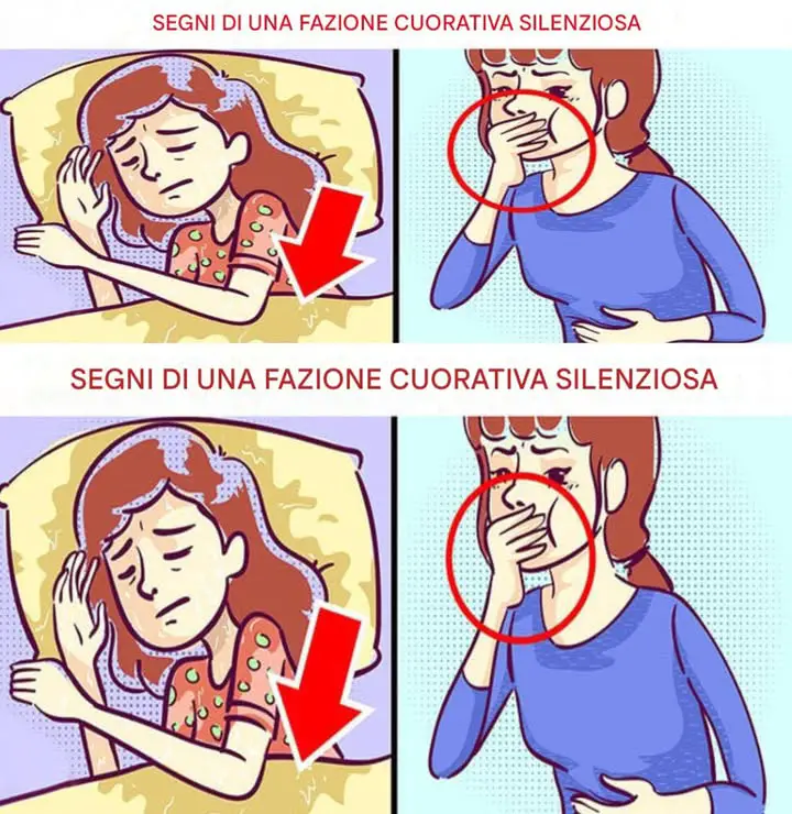 Sei Segnali di un Infarto Silenzioso che Vengono Ancora Ignorati