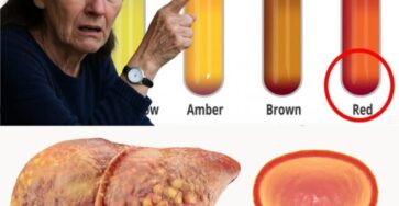 Colore Urine