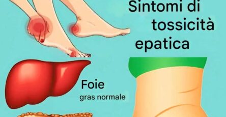11 Segnali Che Il Tuo Fegato Non Funziona Bene E Le Tossine Si Accumulano Nel Tuo Corpo