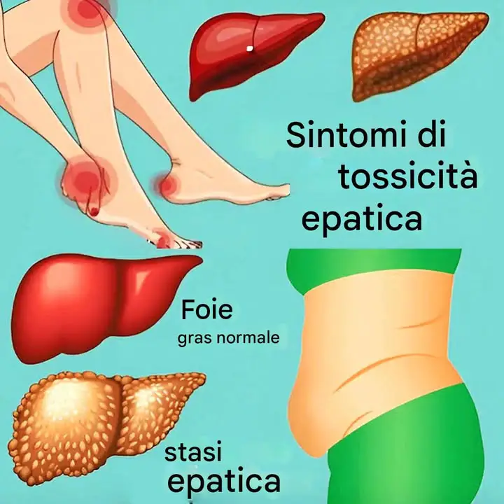 11 Segnali Che Il Tuo Fegato Non Funziona Bene E Le Tossine Si Accumulano Nel Tuo Corpo
