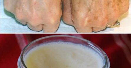Come eliminare macchie della pelle e rughe dalle mani in pochissimo tempo
