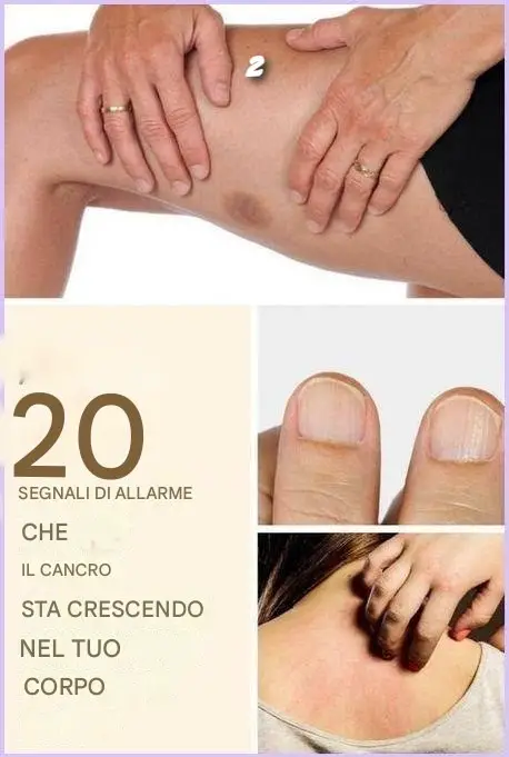 Segnali d’allarme del cancro