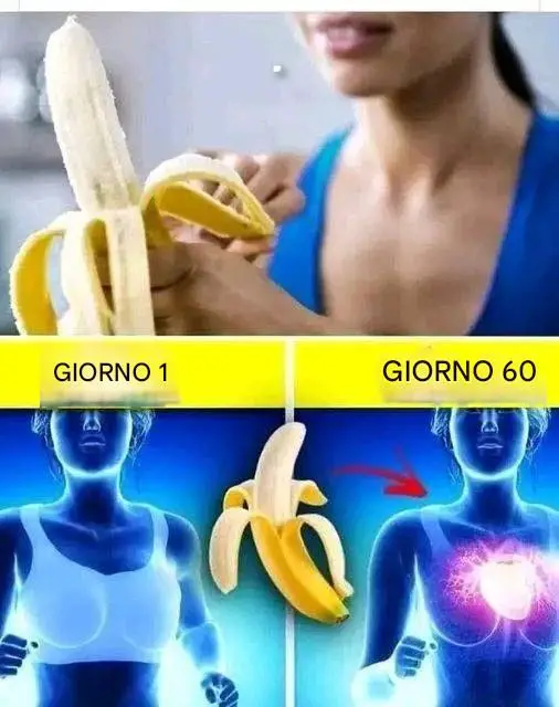 Banana Todos Los Días