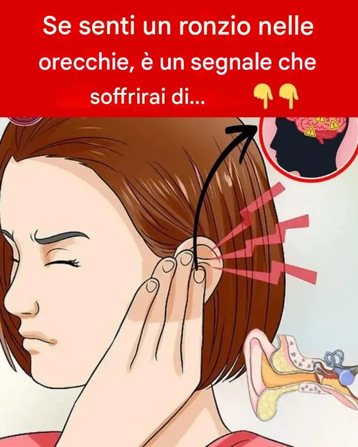 Acufene